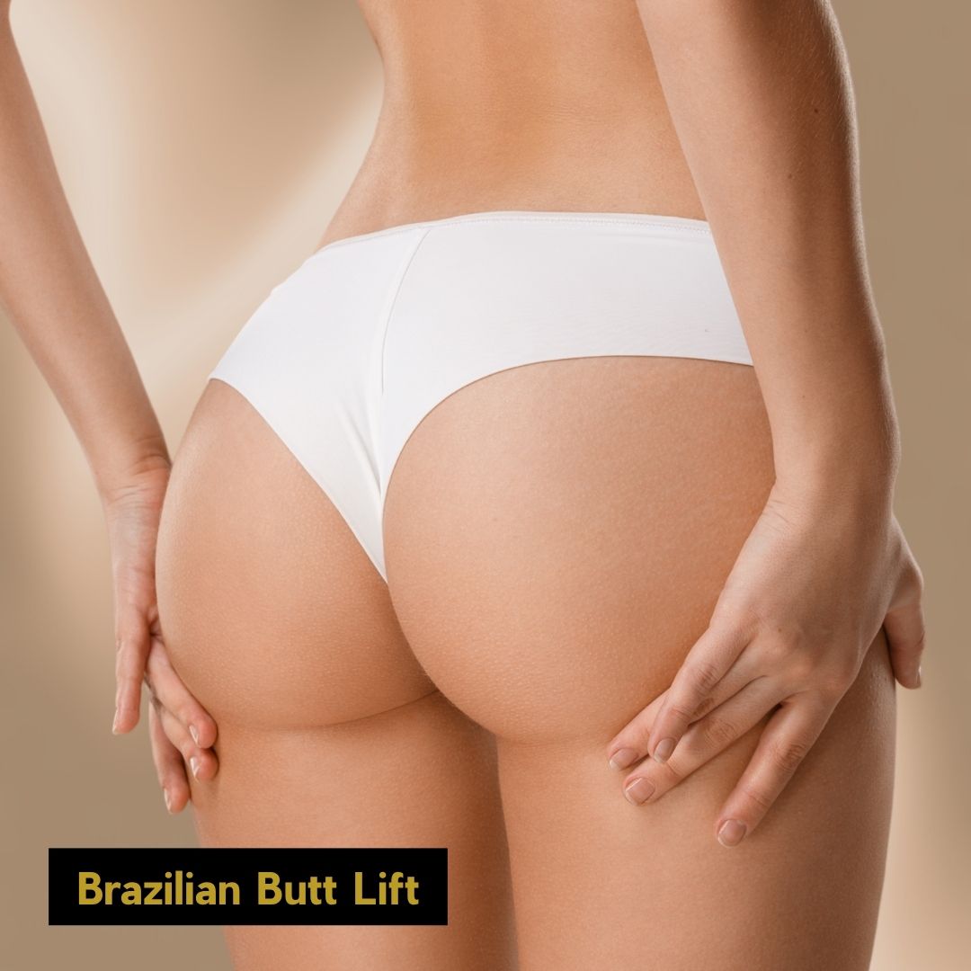 Brazilian Butt Lift (bbl)