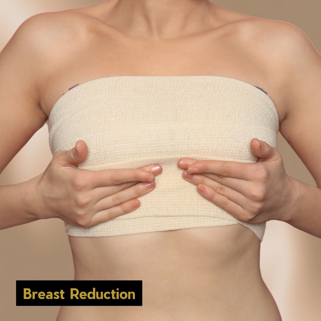 Breast Lift (2)