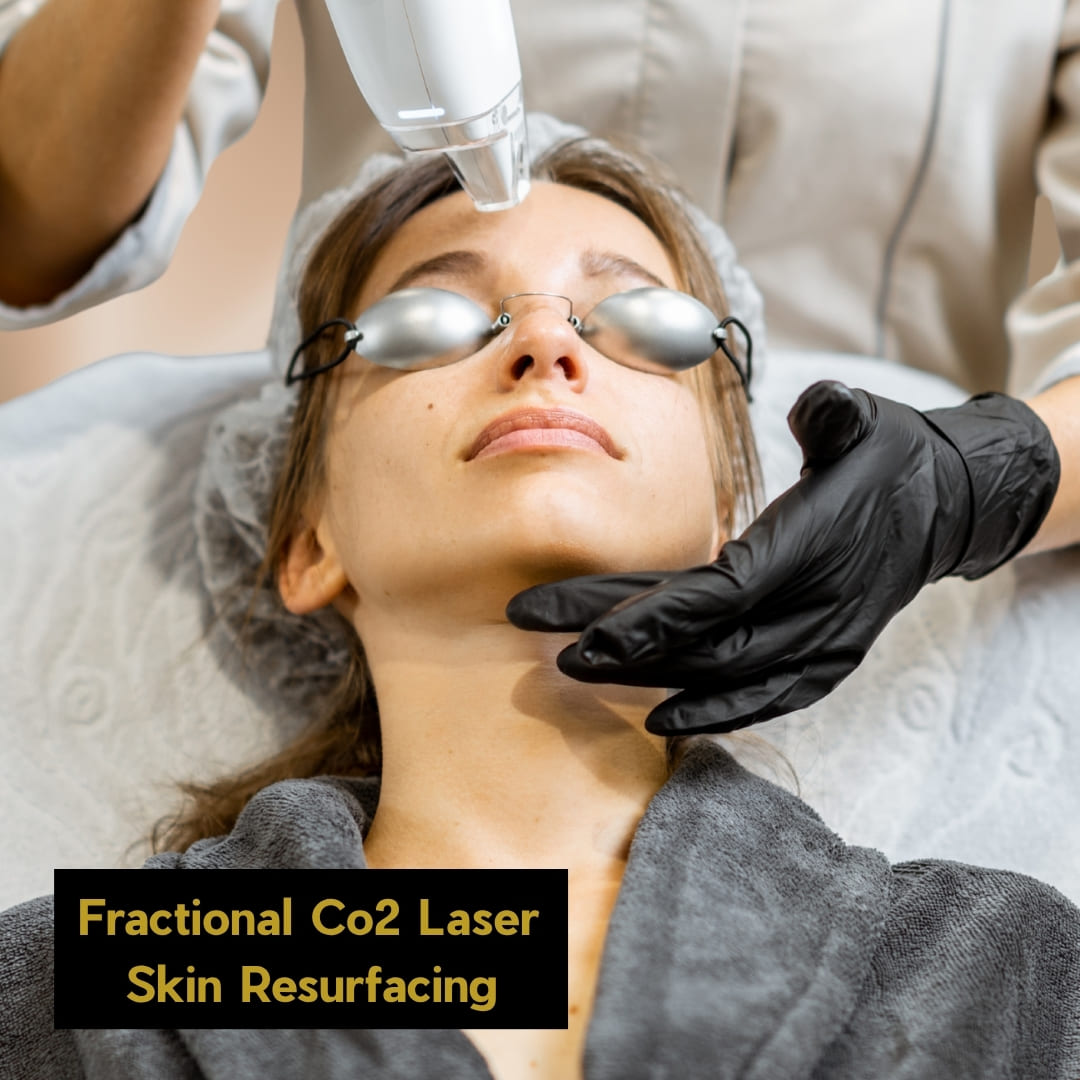 CO2 Laser
