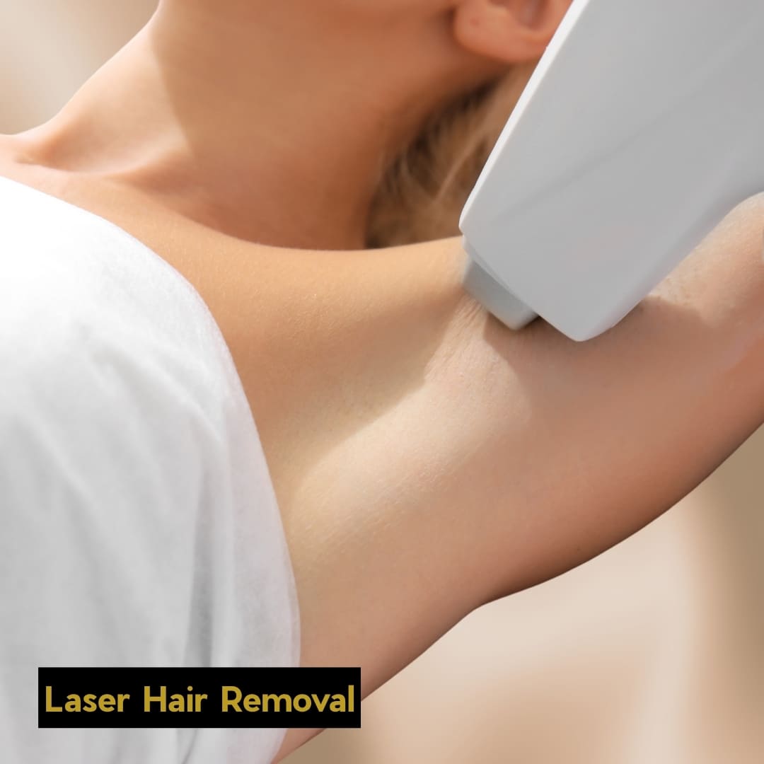 Laser Hair removal