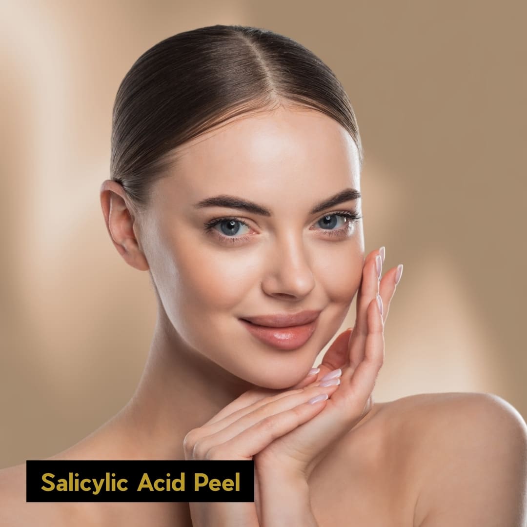 Salicylic Acid Peel