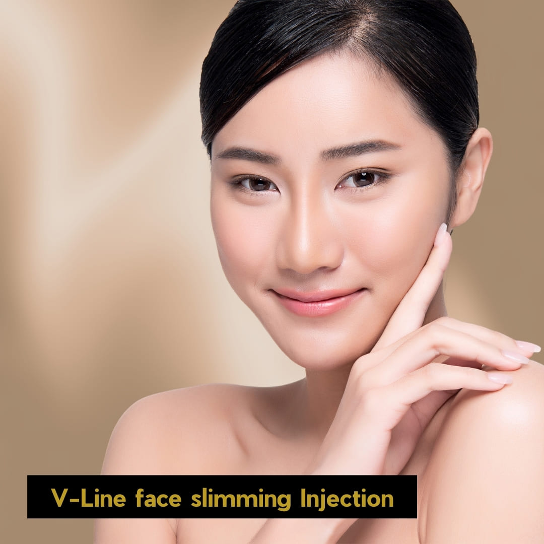 Vline