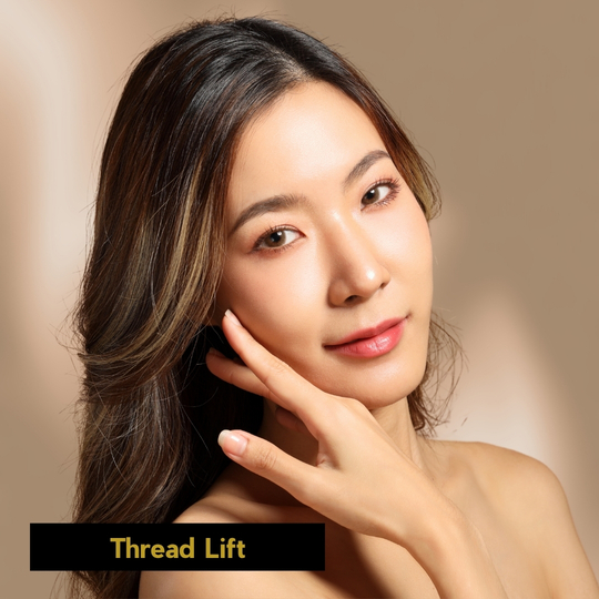 Threadlift