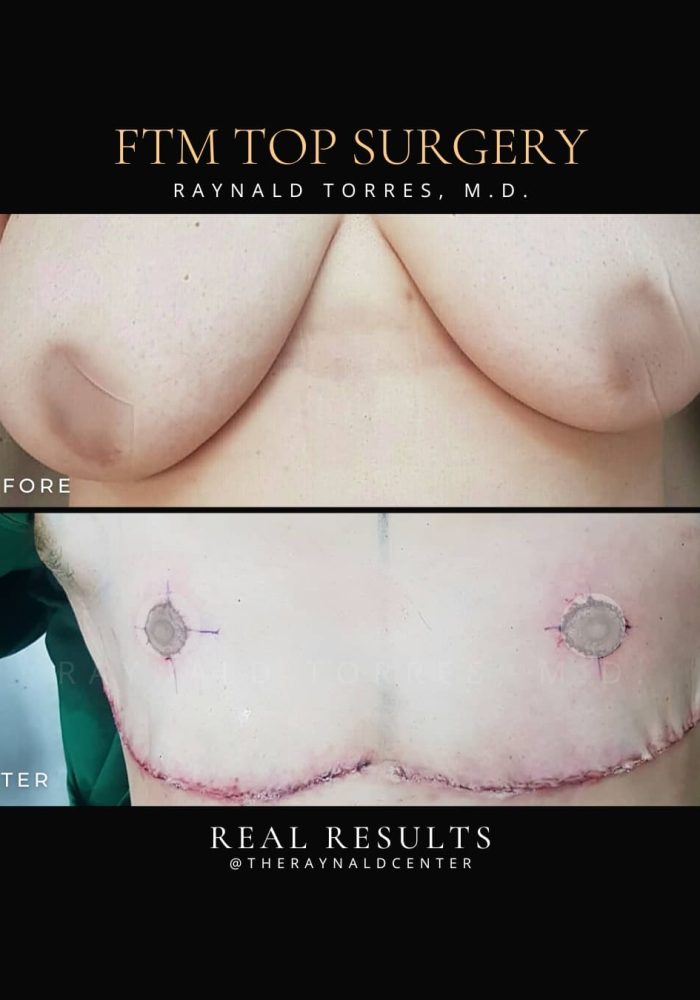 ftm2