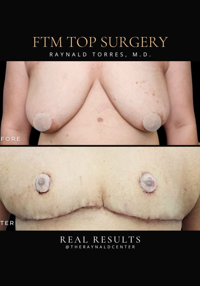 ftm3